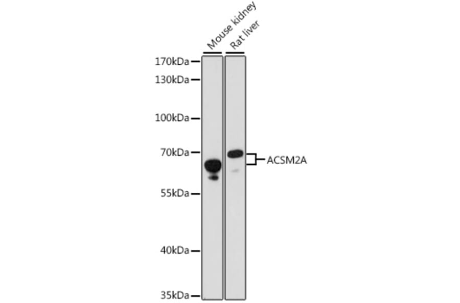 Western Blot - Anti-ACSM2A Antibody (A90800) - Antibodies.com