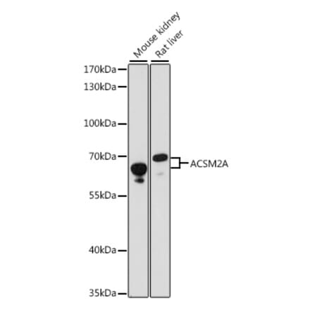 Western Blot - Anti-ACSM2A Antibody (A90800) - Antibodies.com