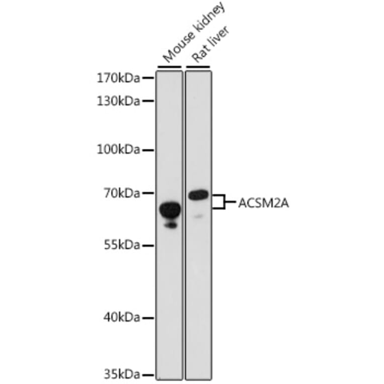 Western Blot - Anti-ACSM2A Antibody (A90800) - Antibodies.com