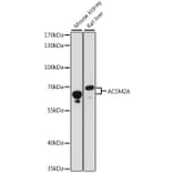Western Blot - Anti-ACSM2A Antibody (A90800) - Antibodies.com