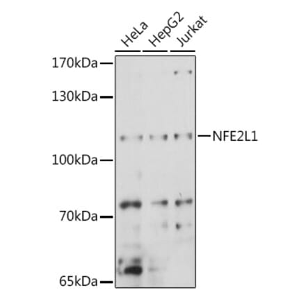 Western Blot - Anti-NFE2L1 Antibody (A90801) - Antibodies.com