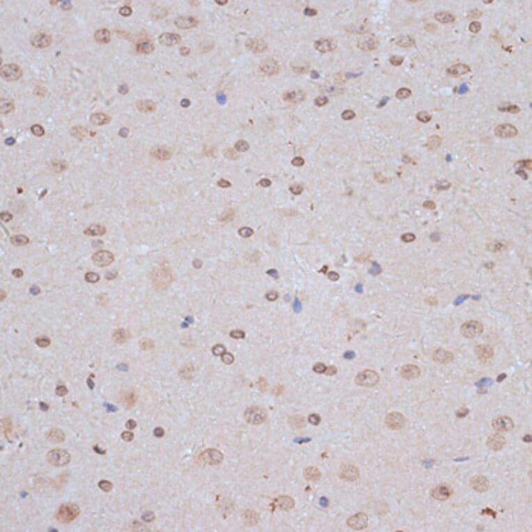 Immunohistochemistry - Anti-NFE2L1 Antibody (A90801) - Antibodies.com