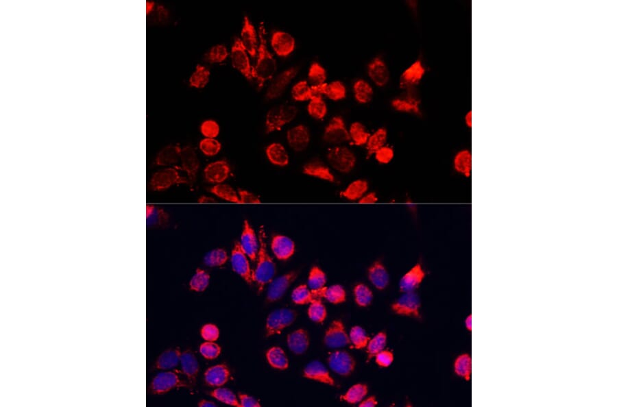 Immunofluorescence - Anti-NFE2L1 Antibody (A90801) - Antibodies.com