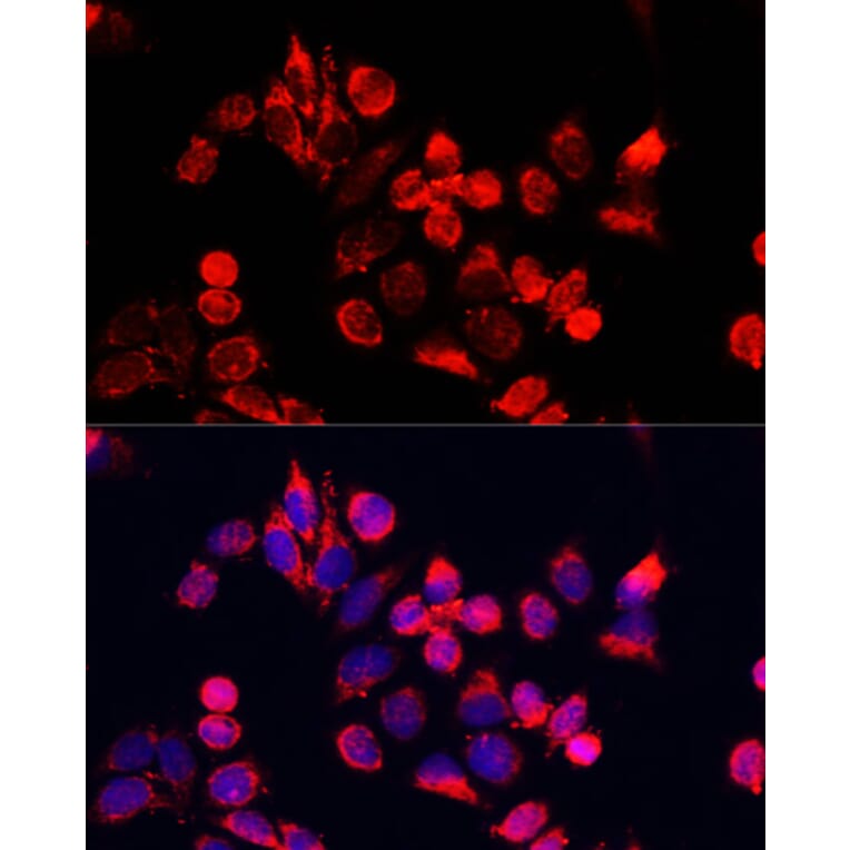 Immunofluorescence - Anti-NFE2L1 Antibody (A90801) - Antibodies.com