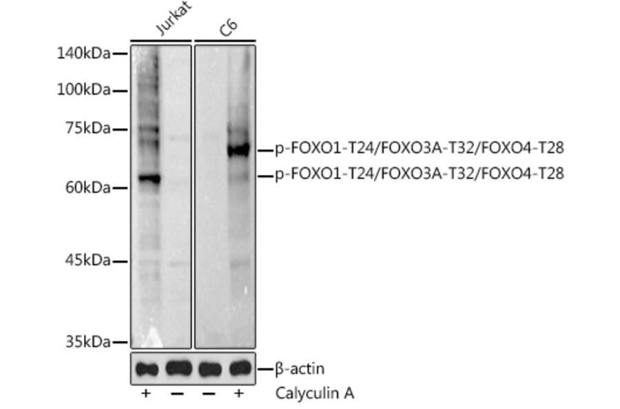 Western Blot - Anti-FOXO1A (phospho Thr24) + FOXO3A (phospho Thr32) + FOXO4 (phospho Thr28) Antibody (A90803) - Antibodies.com