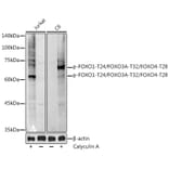 Western Blot - Anti-FOXO1A (phospho Thr24) + FOXO3A (phospho Thr32) + FOXO4 (phospho Thr28) Antibody (A90803) - Antibodies.com