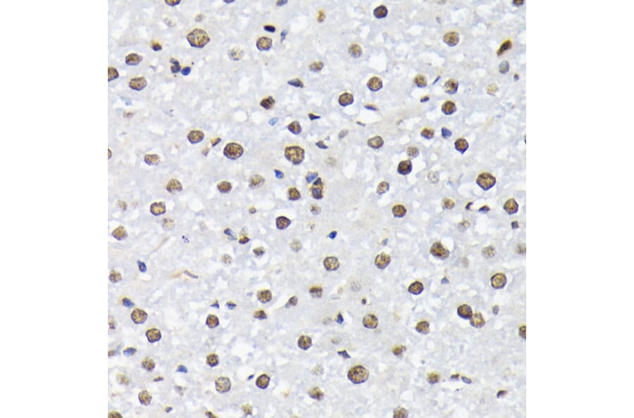 Immunohistochemistry - Anti-FOXO1A (phospho Thr24) + FOXO3A (phospho Thr32) + FOXO4 (phospho Thr28) Antibody (A90803) - Antibodies.com
