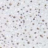 Immunohistochemistry - Anti-FOXO1A (phospho Thr24) + FOXO3A (phospho Thr32) + FOXO4 (phospho Thr28) Antibody (A90803) - Antibodies.com