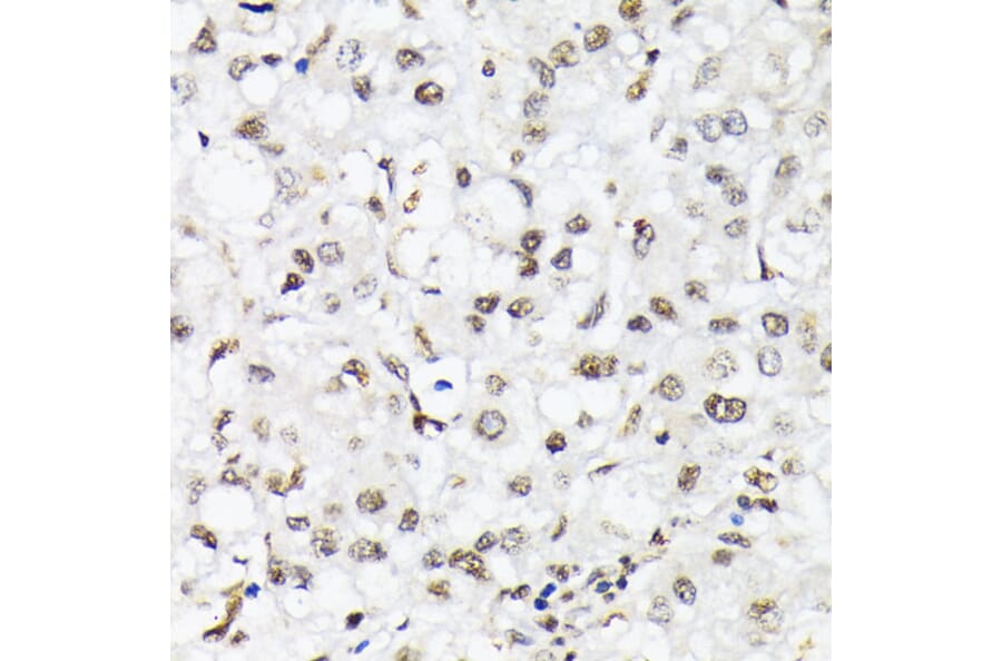 Immunohistochemistry - Anti-FOXO1A (phospho Thr24) + FOXO3A (phospho Thr32) + FOXO4 (phospho Thr28) Antibody (A90803) - Antibodies.com