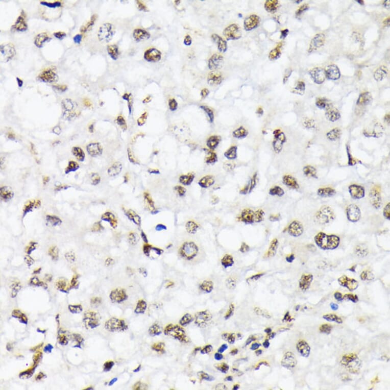 Immunohistochemistry - Anti-FOXO1A (phospho Thr24) + FOXO3A (phospho Thr32) + FOXO4 (phospho Thr28) Antibody (A90803) - Antibodies.com
