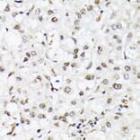 Immunohistochemistry - Anti-FOXO1A (phospho Thr24) + FOXO3A (phospho Thr32) + FOXO4 (phospho Thr28) Antibody (A90803) - Antibodies.com