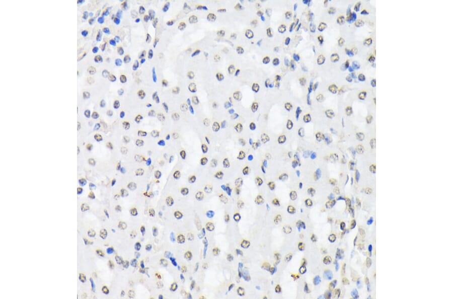 Immunohistochemistry - Anti-FOXO1A (phospho Thr24) + FOXO3A (phospho Thr32) + FOXO4 (phospho Thr28) Antibody (A90803) - Antibodies.com