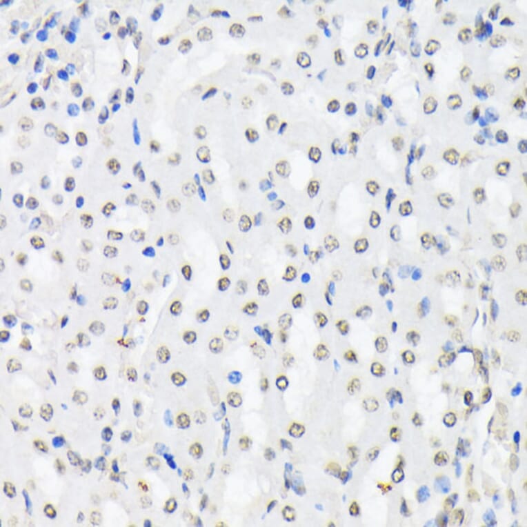 Immunohistochemistry - Anti-FOXO1A (phospho Thr24) + FOXO3A (phospho Thr32) + FOXO4 (phospho Thr28) Antibody (A90803) - Antibodies.com