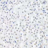 Immunohistochemistry - Anti-FOXO1A (phospho Thr24) + FOXO3A (phospho Thr32) + FOXO4 (phospho Thr28) Antibody (A90803) - Antibodies.com