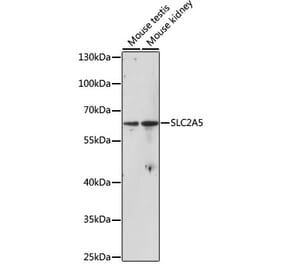 Western Blot - Anti-GLUT5 Antibody (A90805) - Antibodies.com