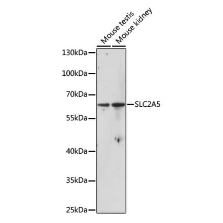 Western Blot - Anti-GLUT5 Antibody (A90805) - Antibodies.com