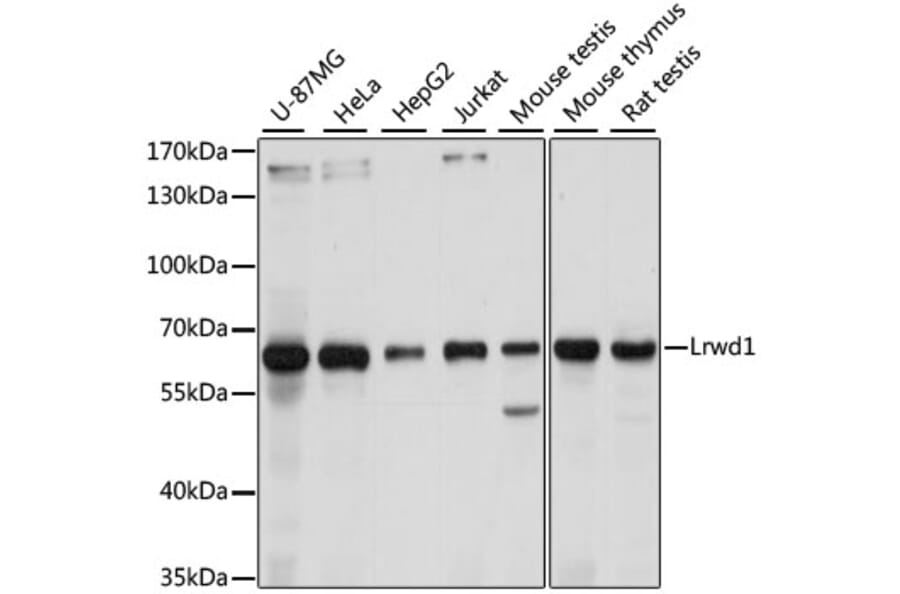 Western Blot - Anti-Lrwd1 Antibody (A15576) - Antibodies.com