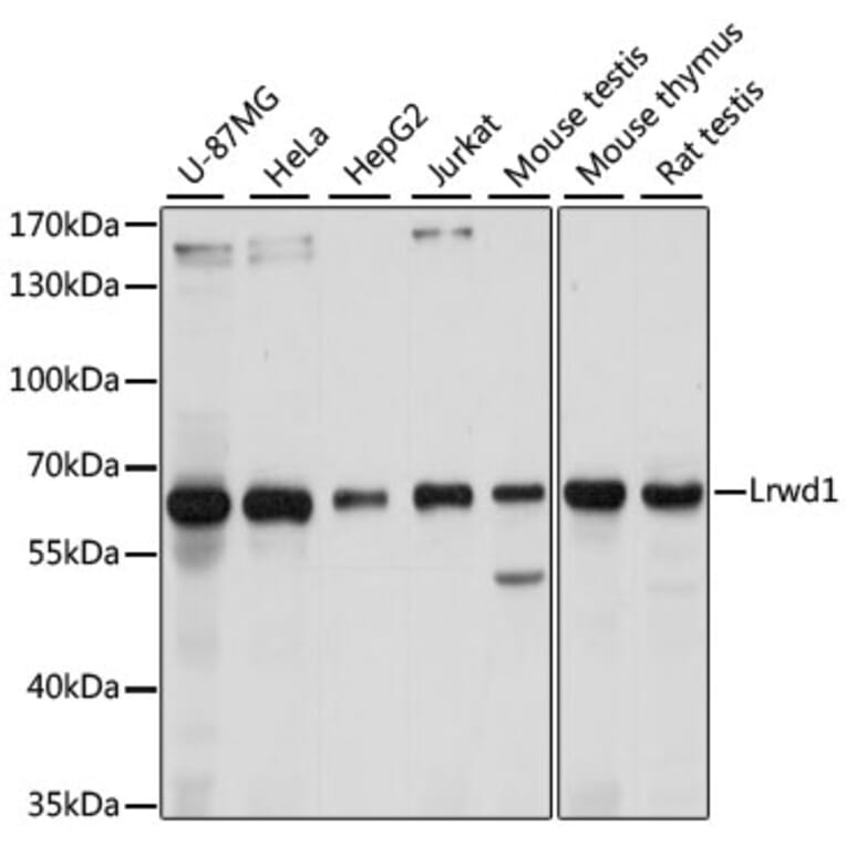 Western Blot - Anti-Lrwd1 Antibody (A15576) - Antibodies.com