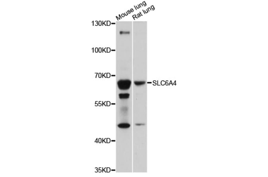 Western Blot - Anti-SLC6A4 Antibody (A14782) - Antibodies.com