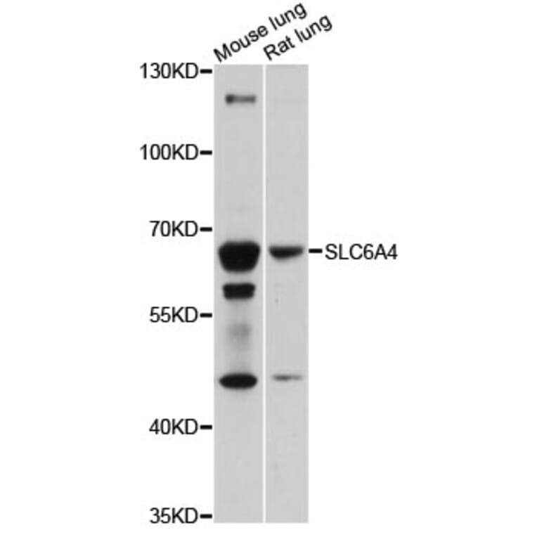 Western Blot - Anti-SLC6A4 Antibody (A14782) - Antibodies.com