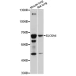 Western Blot - Anti-SLC6A4 Antibody (A14782) - Antibodies.com