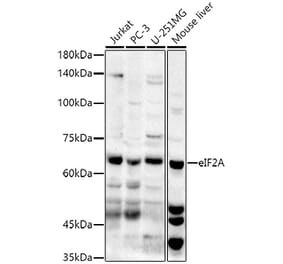 Western Blot - Anti-eIF2A Antibody (A90809) - Antibodies.com