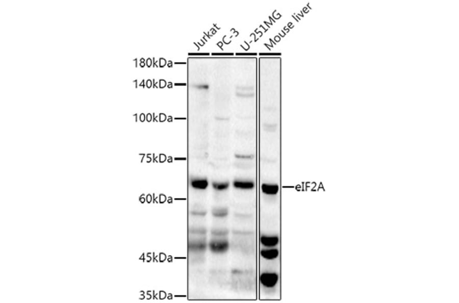 Western Blot - Anti-eIF2A Antibody (A90809) - Antibodies.com