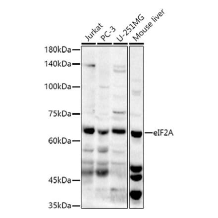 Western Blot - Anti-eIF2A Antibody (A90809) - Antibodies.com