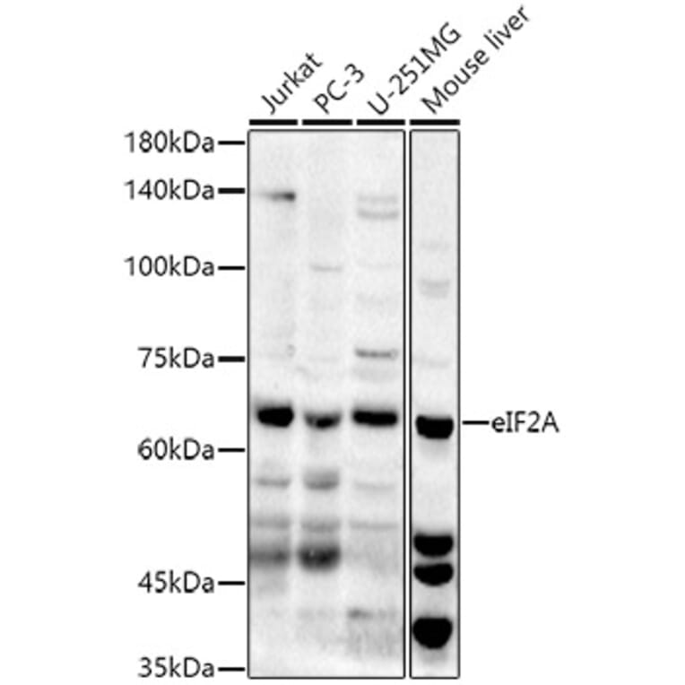 Western Blot - Anti-eIF2A Antibody (A90809) - Antibodies.com