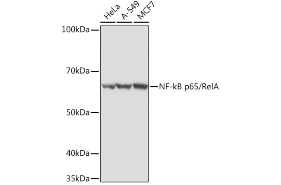 Western Blot - Anti-NF-kB p65 Antibody (A90811) - Antibodies.com