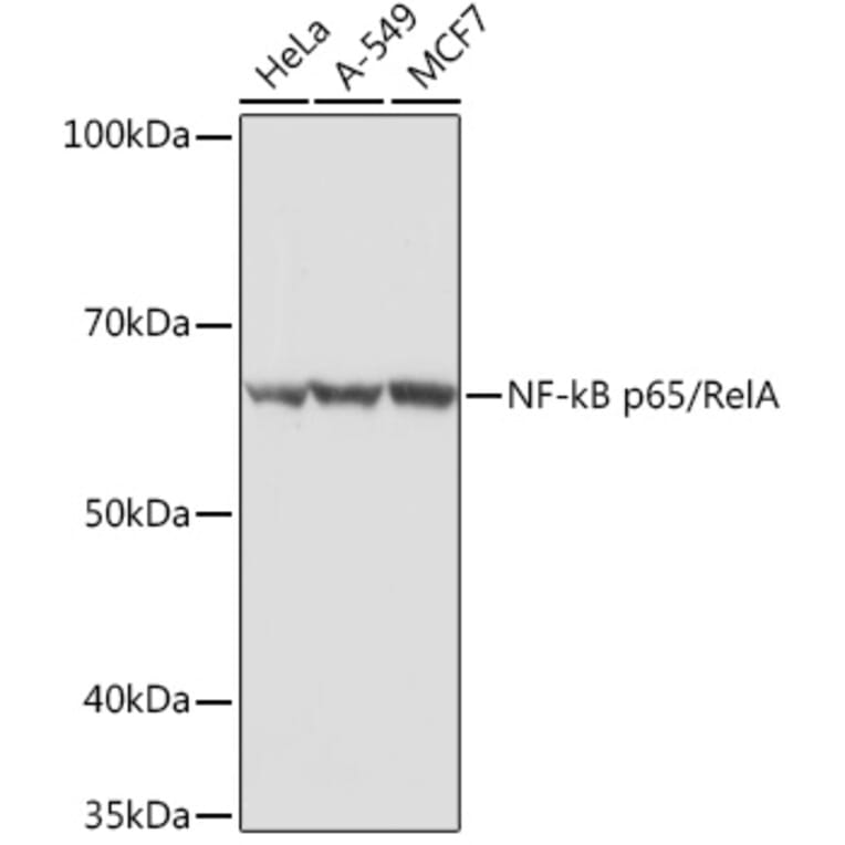 Western Blot - Anti-NF-kB p65 Antibody (A90811) - Antibodies.com