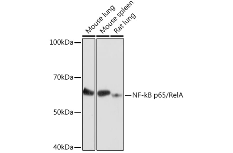 Western Blot - Anti-NF-kB p65 Antibody (A90811) - Antibodies.com