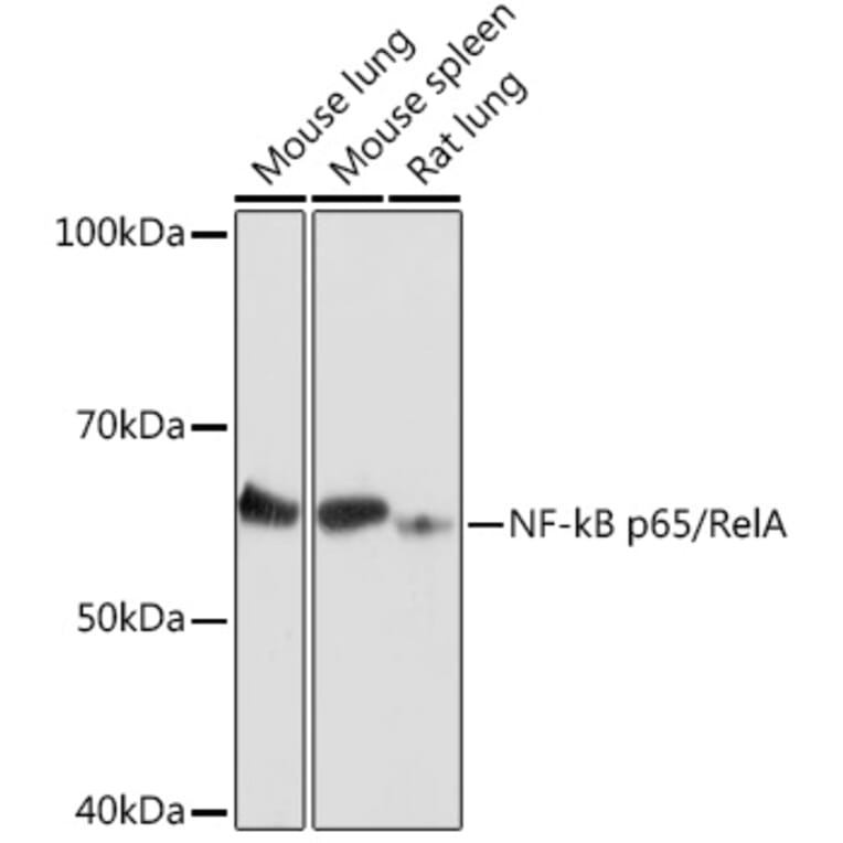 Western Blot - Anti-NF-kB p65 Antibody (A90811) - Antibodies.com
