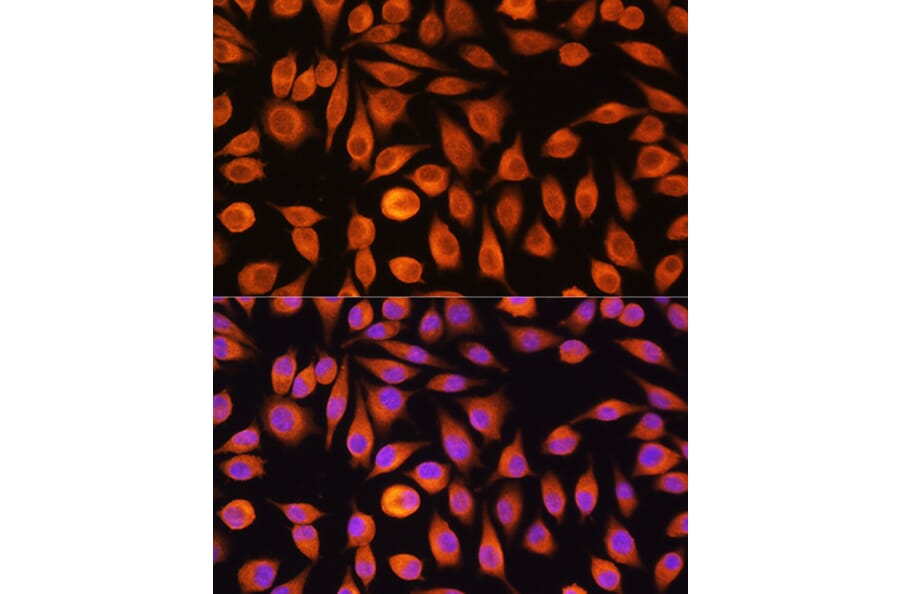 Immunofluorescence - Anti-NF-kB p65 Antibody (A90811) - Antibodies.com