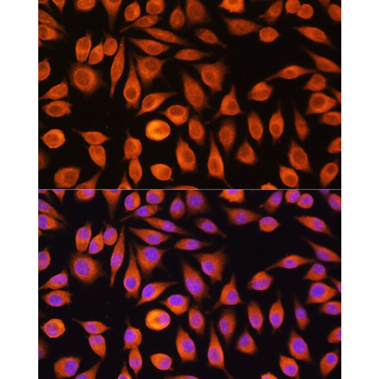 Immunofluorescence - Anti-NF-kB p65 Antibody (A90811) - Antibodies.com