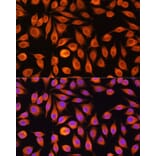 Immunofluorescence - Anti-NF-kB p65 Antibody (A90811) - Antibodies.com