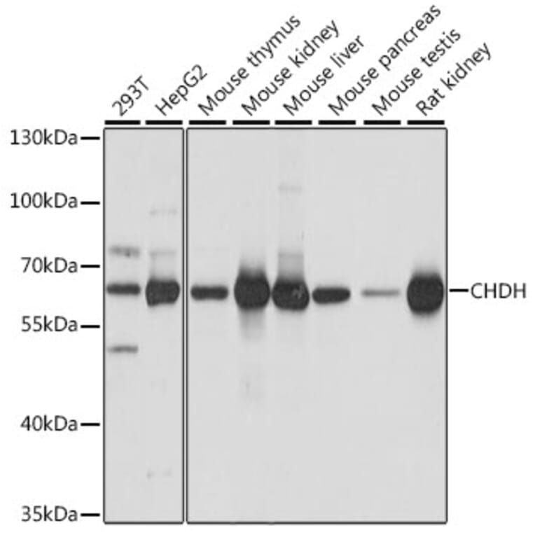 Western Blot - Anti-CHDH Antibody (A90813) - Antibodies.com