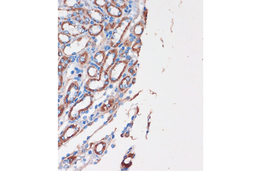 Immunohistochemistry - Anti-CHDH Antibody (A90813) - Antibodies.com