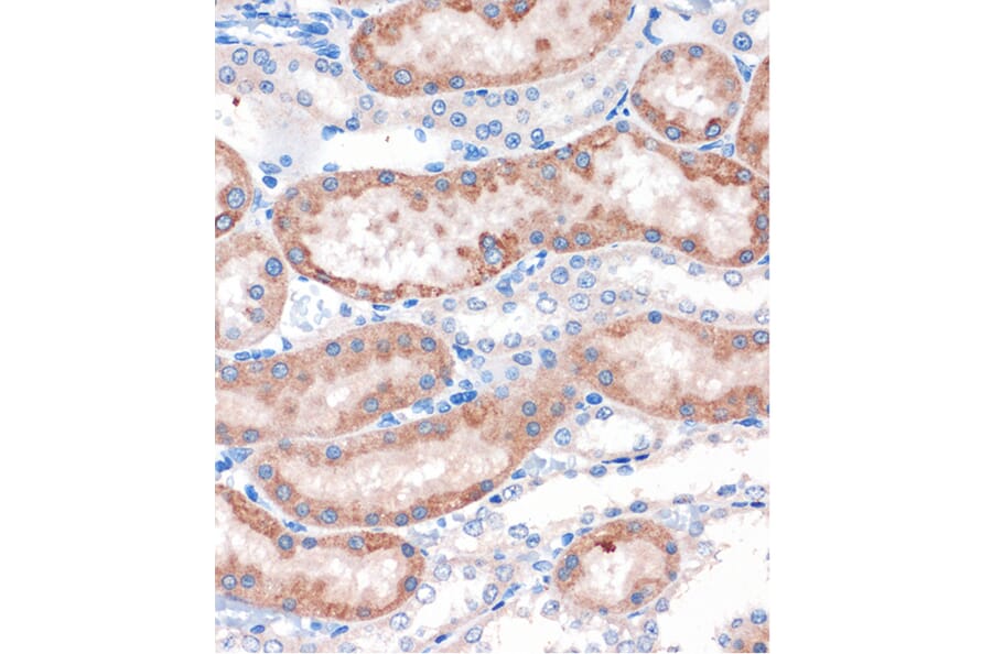 Immunohistochemistry - Anti-CHDH Antibody (A90813) - Antibodies.com