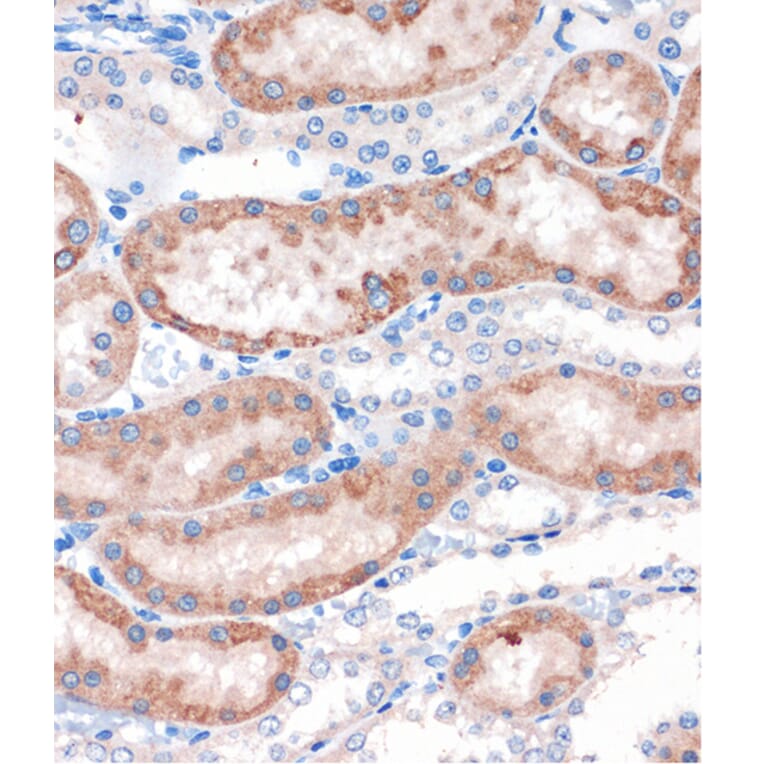 Immunohistochemistry - Anti-CHDH Antibody (A90813) - Antibodies.com