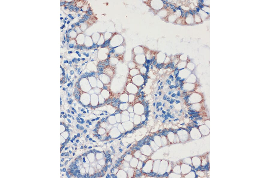 Immunohistochemistry - Anti-CHDH Antibody (A90813) - Antibodies.com
