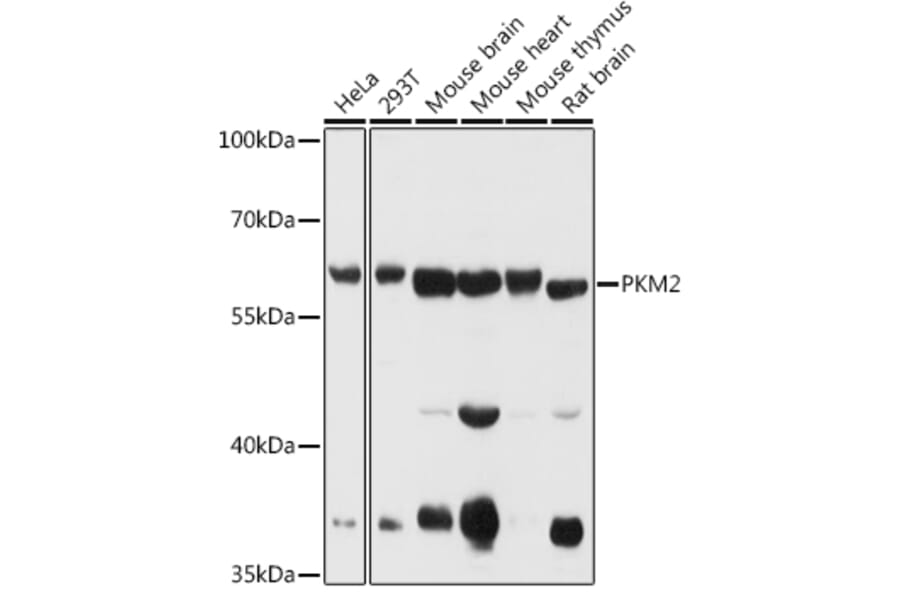 Western Blot - Anti-PKM Antibody (A90814) - Antibodies.com