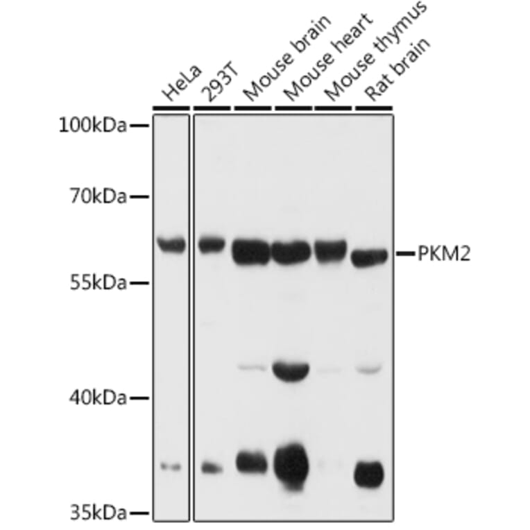 Western Blot - Anti-PKM Antibody (A90814) - Antibodies.com