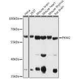 Western Blot - Anti-PKM Antibody (A90814) - Antibodies.com