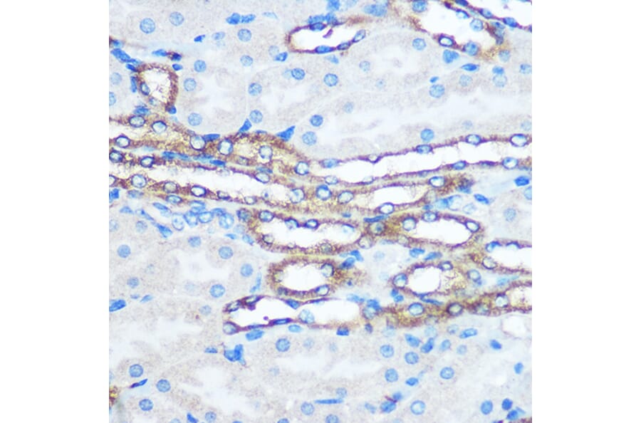 Immunohistochemistry - Anti-PKM Antibody (A90814) - Antibodies.com