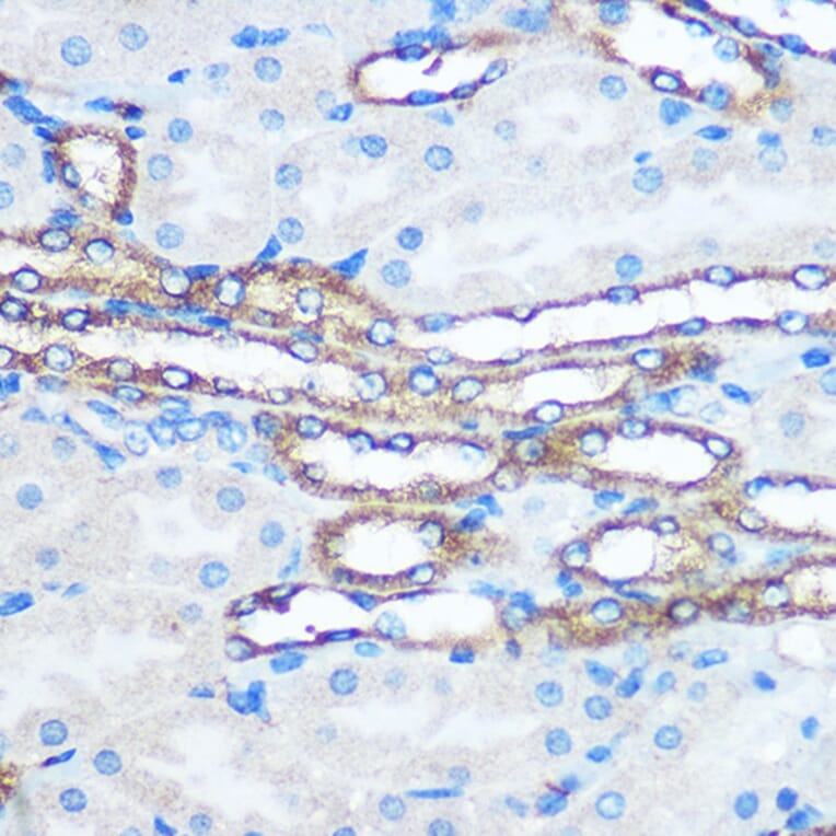 Immunohistochemistry - Anti-PKM Antibody (A90814) - Antibodies.com