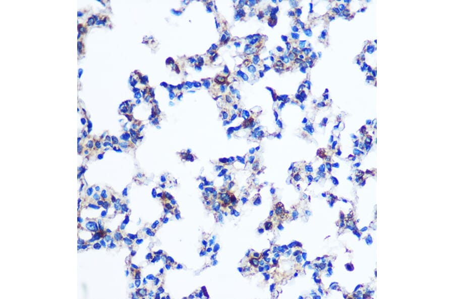 Immunohistochemistry - Anti-PKM Antibody (A90814) - Antibodies.com
