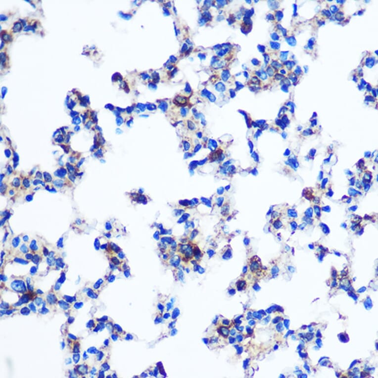 Immunohistochemistry - Anti-PKM Antibody (A90814) - Antibodies.com