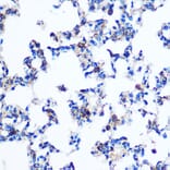 Immunohistochemistry - Anti-PKM Antibody (A90814) - Antibodies.com