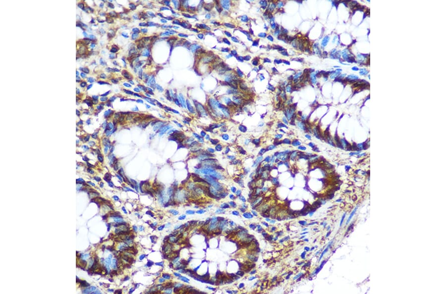 Immunohistochemistry - Anti-PKM Antibody (A90814) - Antibodies.com